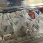 Deposit NY tubal reversal baby boy born a little early