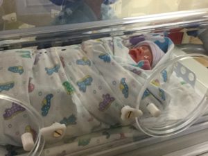 Deposit NY tubal reversal baby boy born a little early