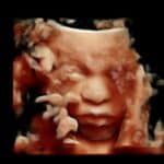 4d-ultrasound-tubal-reversal-baby-lenoir-tennessee